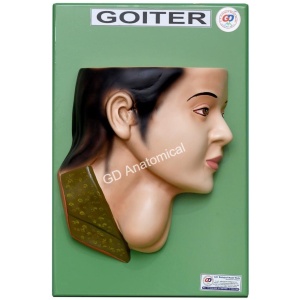Goiter Model