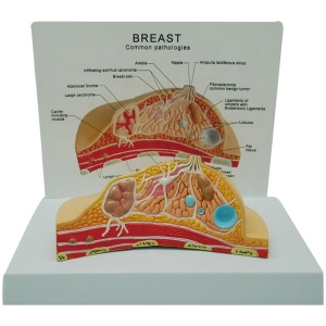 Breast Pathologies Model