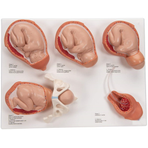 Labor Stages Model, Small